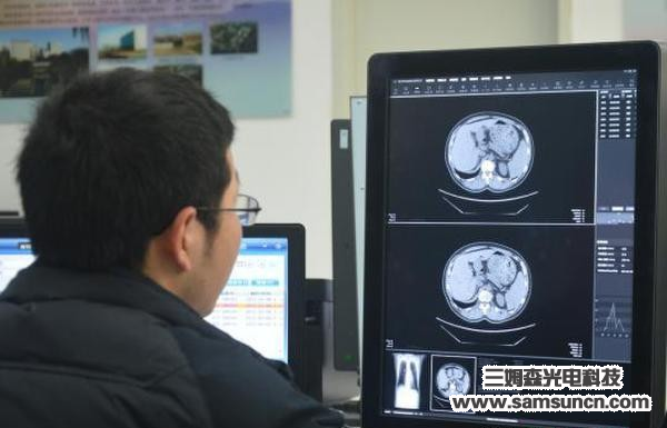 Lung cancer recognition robot used in clinical trials Medical robots have a bright future_shanqinquan.com