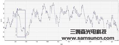 Scratch detection of precision aluminum parts_shanqinquan.com