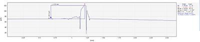 Convex hull detection of laser welding slag_shanqinquan.com